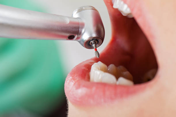 Best Urgent Care for Lost Fillings or Crowns in Kenly, NC